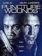 Click image for larger version

Name:	puncture-wounds.jpg
Views:	1
Size:	19.1 KB
ID:	44004